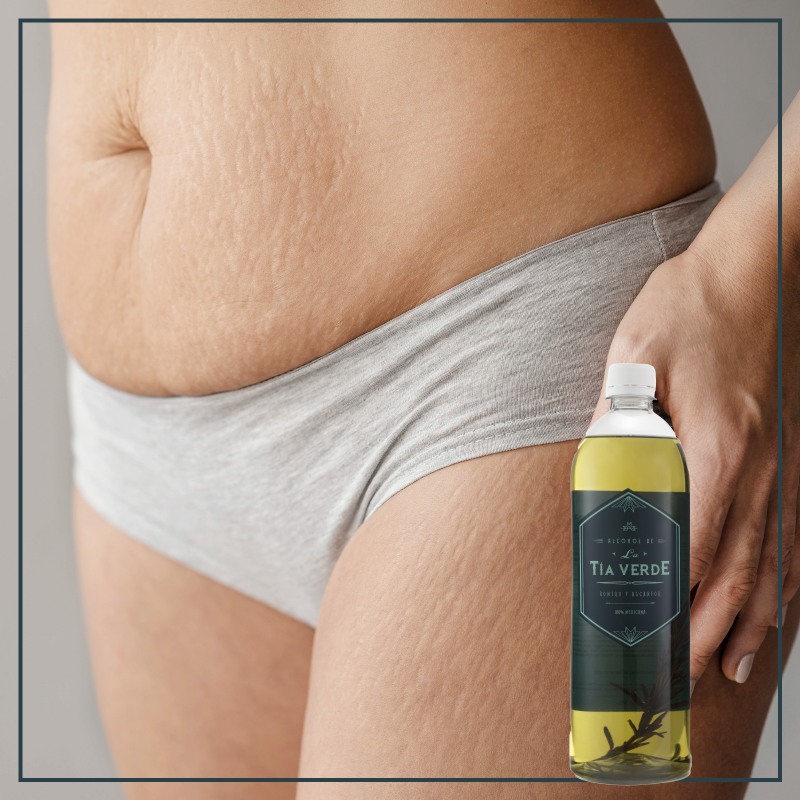 ¿Sabes cómo cuidar tu piel durante el embarazo?