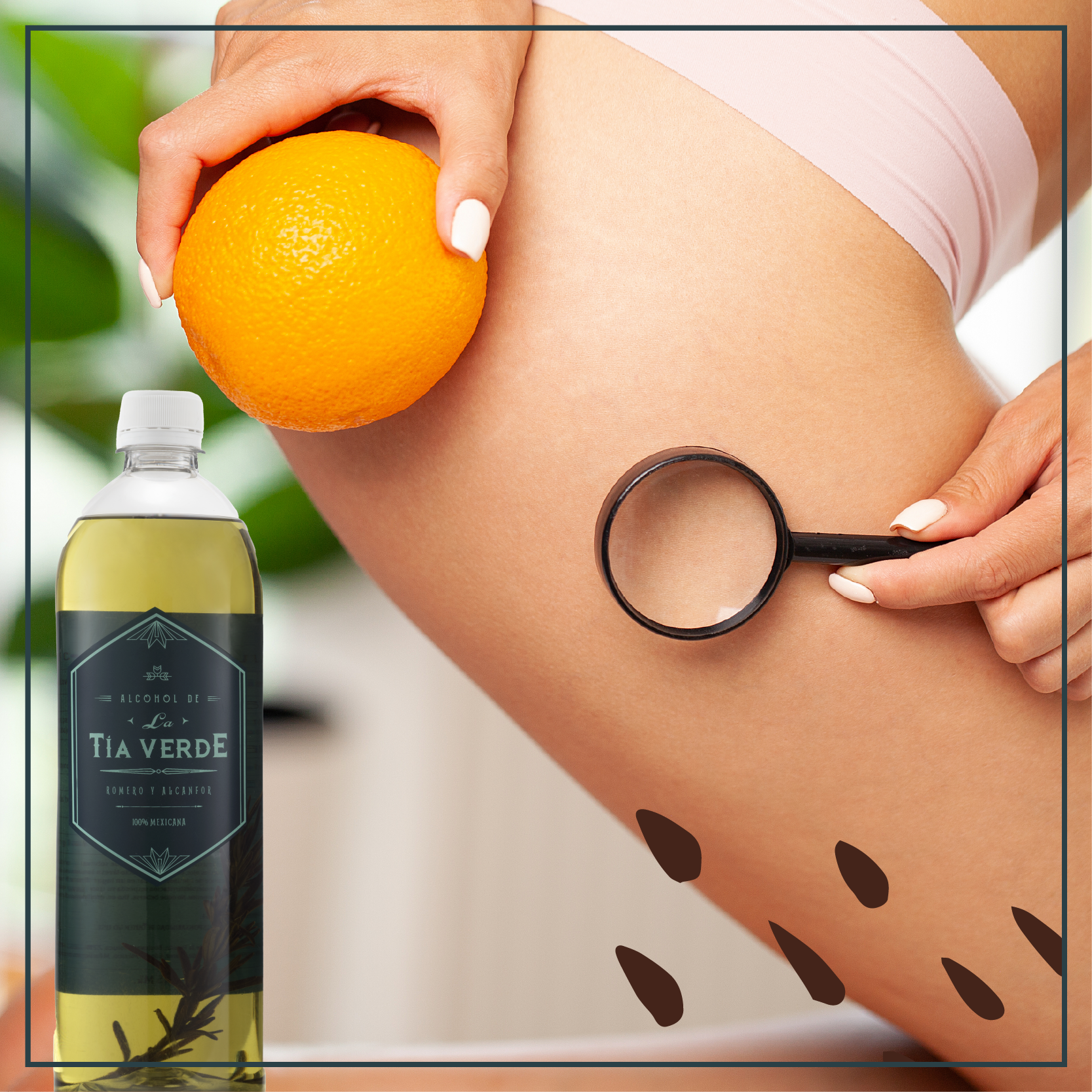 ¿Sabes qué es y cómo prevenir la celulitis?