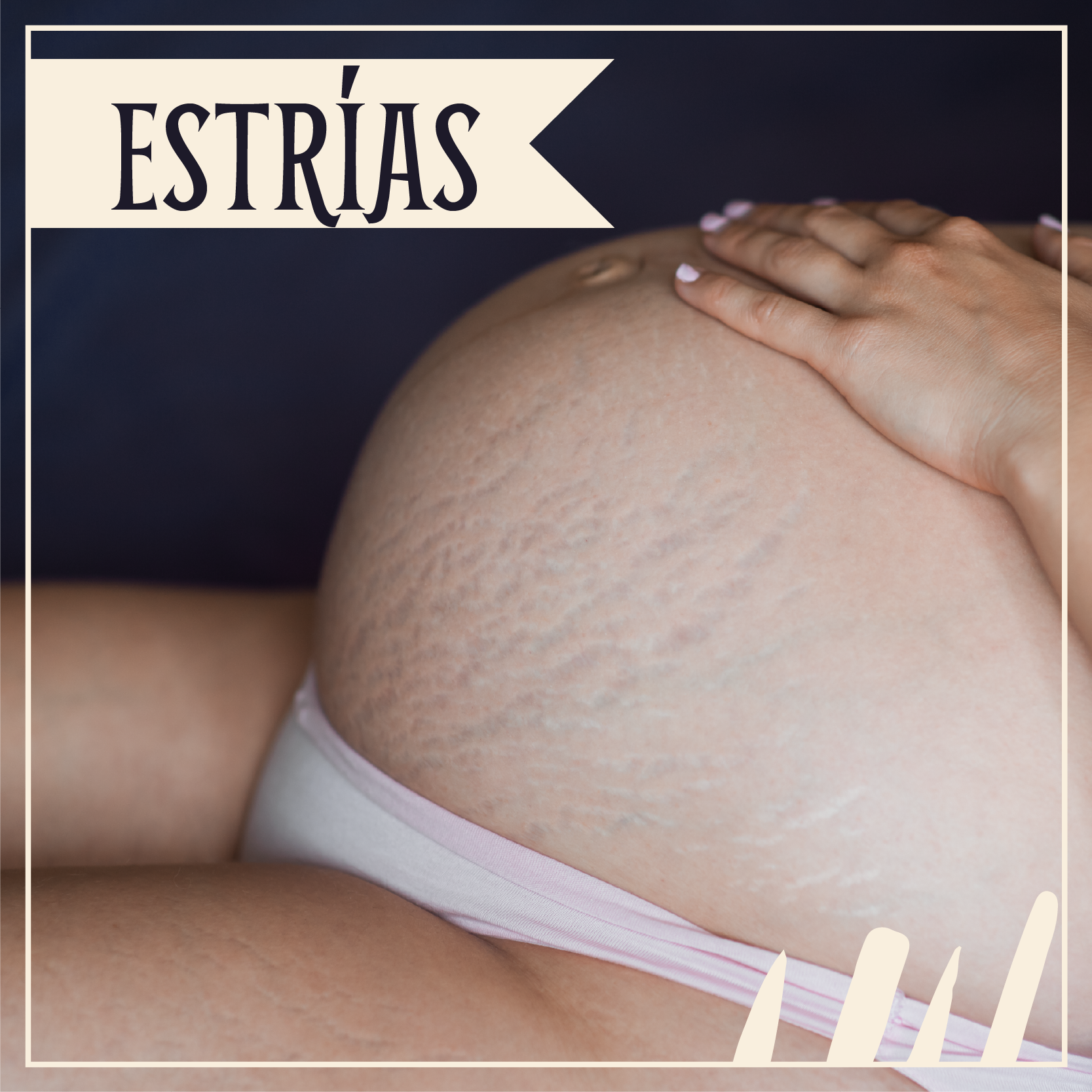 La celulitis y las estrías rojas en hombres y mujeres